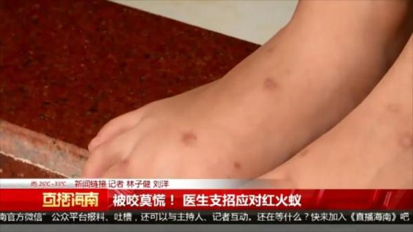 严重可致死！看到千万警惕，多名村民被咬伤