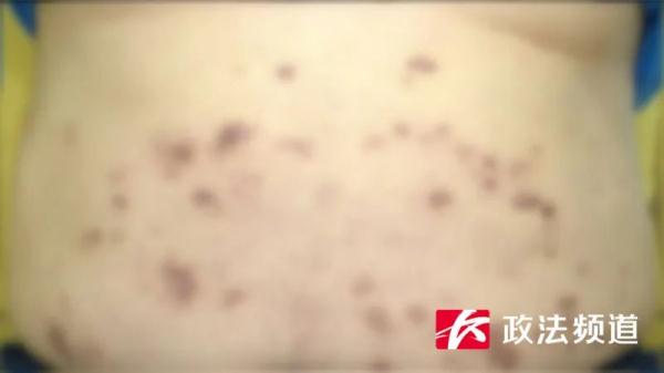 从“什么都不缺”的富家子弟到体无完肤的“瘾君子”,只因他走错了这一步 从“什么都不缺”的富家子弟到体无完肤的“瘾君子”,只因他走错了这一步