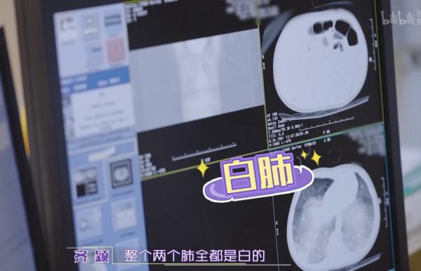 1岁男童差点没命!很多人正在使用,家长务必小心 1岁男童差点没命!很多人正在使用,家长务必小心