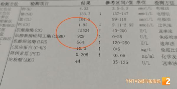 情况严重！4名贵州患者吃菌中毒，紧急转至云南抢救！