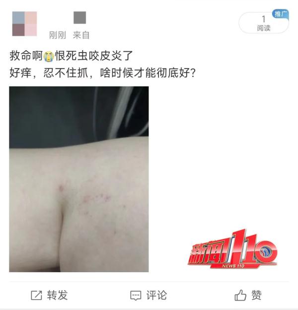 近期高发!出门一圈全身出现几十处!福州已有人因此“白肺”…… 近期高发!出门一圈全身出现几十处!福州已有人因此“白肺”……
