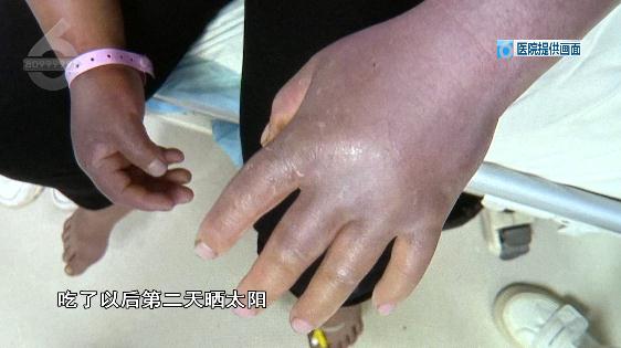 紧急跨省转运抢救！贵州6人吃菌中毒，4人急送昆明抢救……