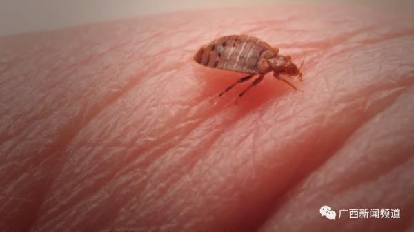夏季高发！男子野外钓鱼感染恙虫病，高烧40度危及生命