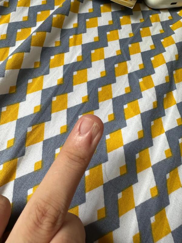 指甲上突然长了一条…上热搜！网友慌了！