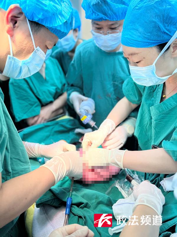 肠子裸露体外，婴儿刚出生4小时就经历救命手术