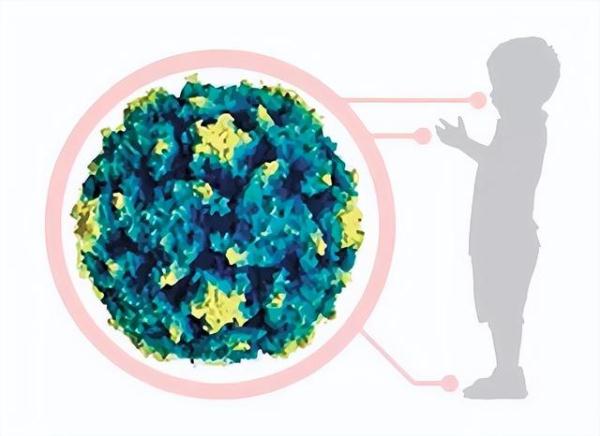 这种病毒一旦“发狠”,杀伤力大到猝不及防!如何识别重症? 这种病毒一旦“发狠”,杀伤力大到猝不及防!如何识别重症?