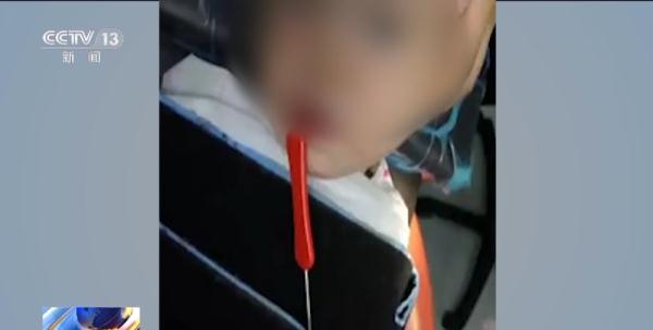 蜡烛火苗超600摄氏度！火漆印章存在烫伤、刺伤和窒息风险