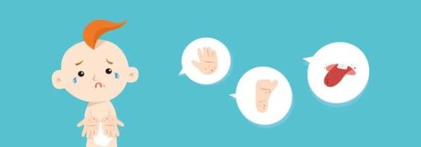 这种病毒一旦“发狠”,杀伤力大到猝不及防!如何识别重症? 这种病毒一旦“发狠”,杀伤力大到猝不及防!如何识别重症?