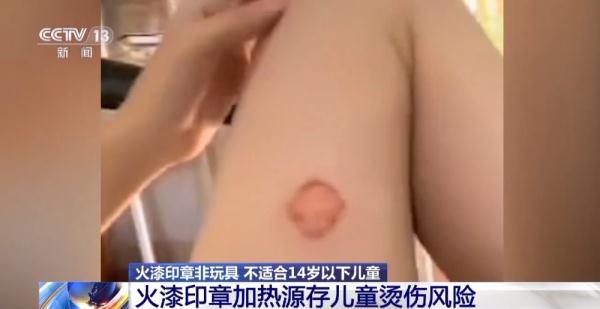 蜡烛火苗超600摄氏度！火漆印章存在烫伤、刺伤和窒息风险
