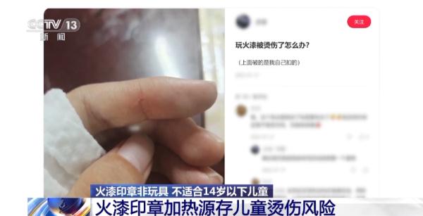 蜡烛火苗超600摄氏度！火漆印章存在烫伤、刺伤和窒息风险