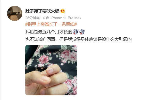 冲上热搜！指甲上突然长黑线，网友们慌了