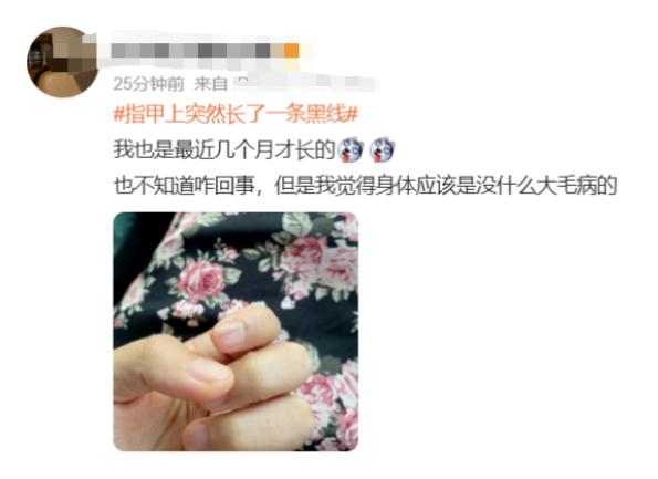 热搜！指甲上长出一条黑线，网友慌了……