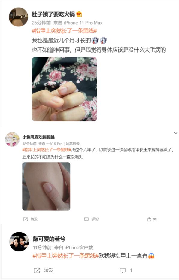 赶紧看自己的手！指甲上突然长了一条…上热搜！网友慌了