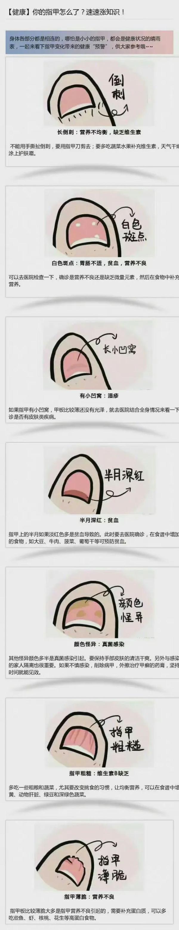 赶紧看自己的手！指甲上突然长了一条…上热搜！网友慌了