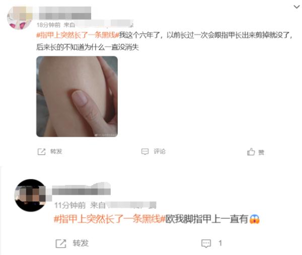 热搜！指甲上长出一条黑线，网友慌了……