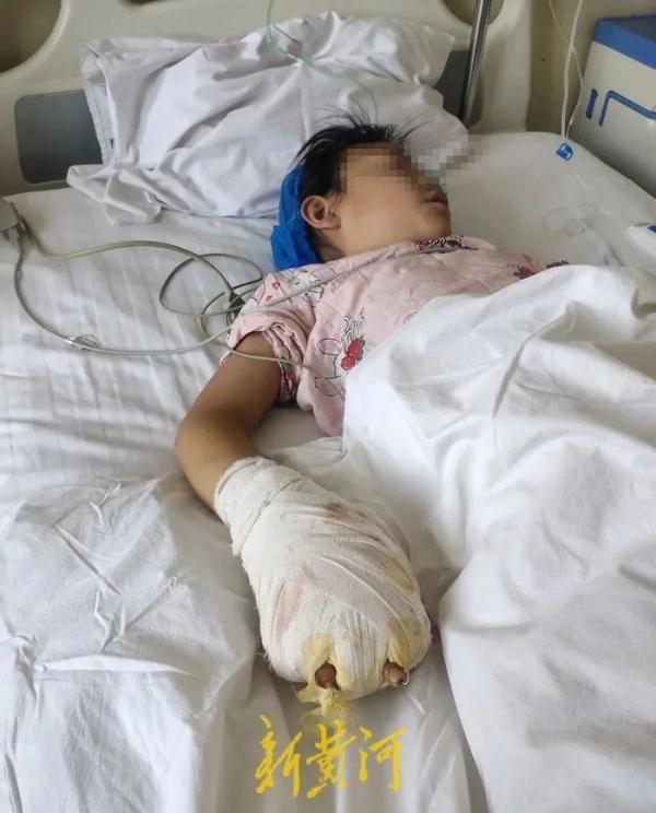 热水烫、殴打……女童遭继母虐待致残，其父称绝不和解