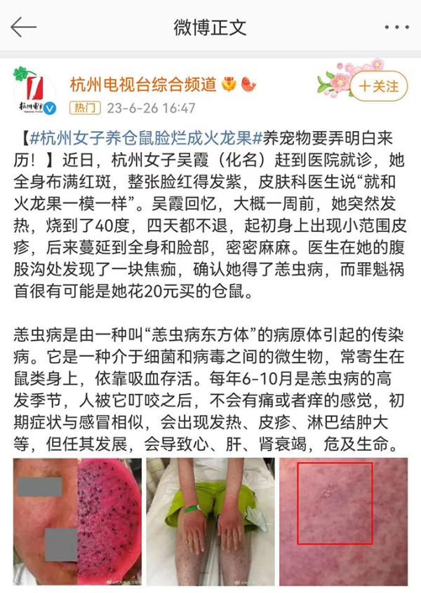 因养仓鼠致脸烂成火龙果？专家提醒来源不明宠物有传染病风险