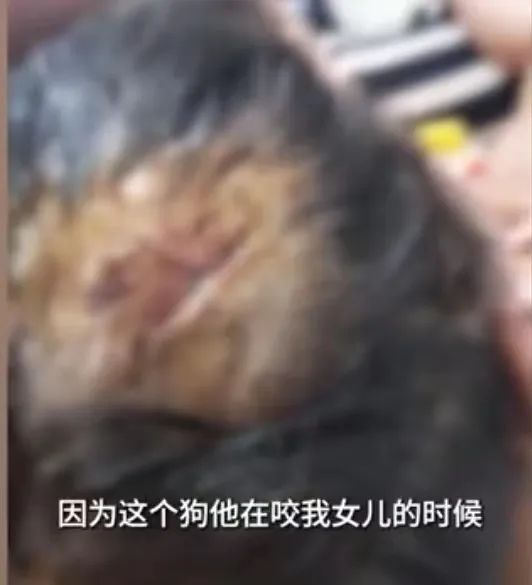 女子疑遛狗不拴绳咬伤女童，警方回应