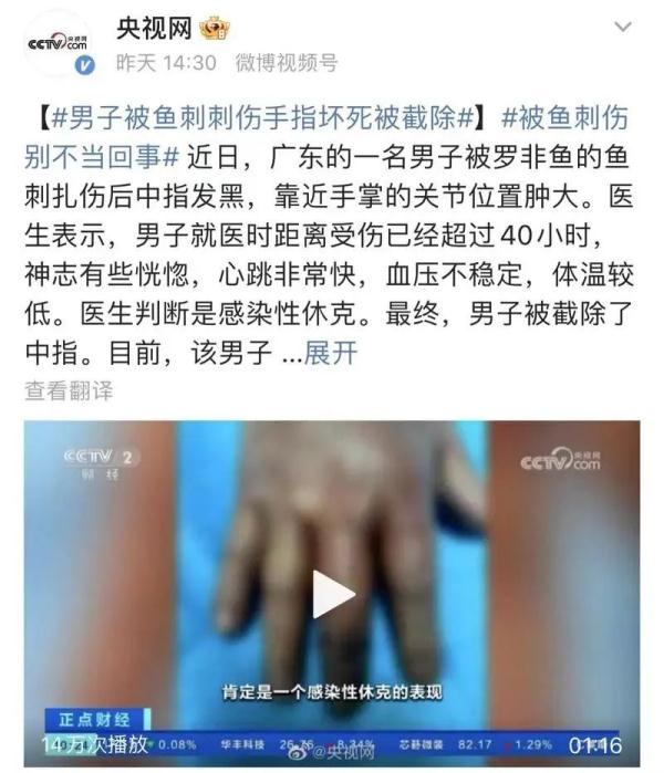 因一条罗非鱼，男子痛失手指！被鱼刺伤别不当回事