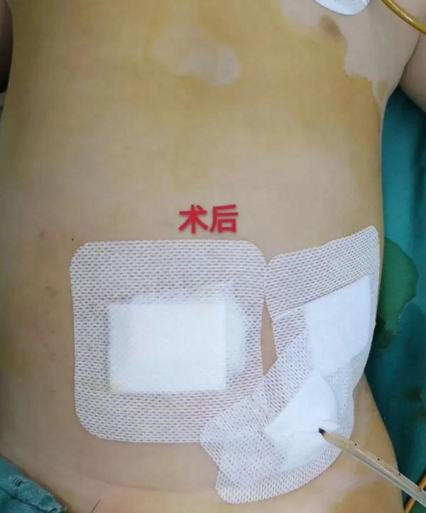 小心！又有孩子因为这种玩具住院 很多人家里都有
