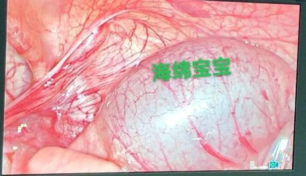 小心！又有孩子因为这种玩具住院 很多人家里都有