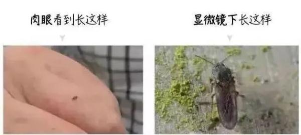 这个“吸血鬼”，比蚊子还猛还难缠！5招能治它