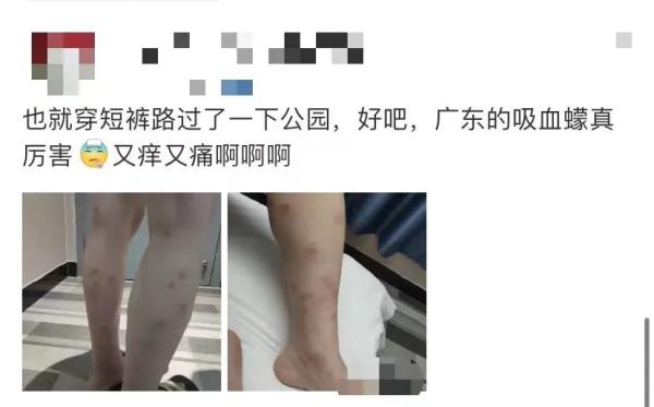 这个“吸血鬼”，比蚊子还猛还难缠！5招能治它