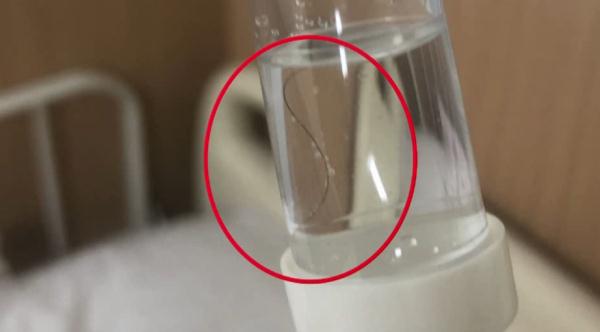 医院输液管中疑似有毛发？多部门介入调查