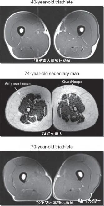 坚持运动的人和从不运动的人有什么差别？很多人看完后悔了