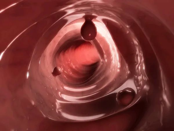 什么样的肠息肉容易癌变？有一种要特别当心！