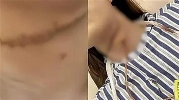 丈夫将妻子“割喉”，获刑一年六个月！妻子发声