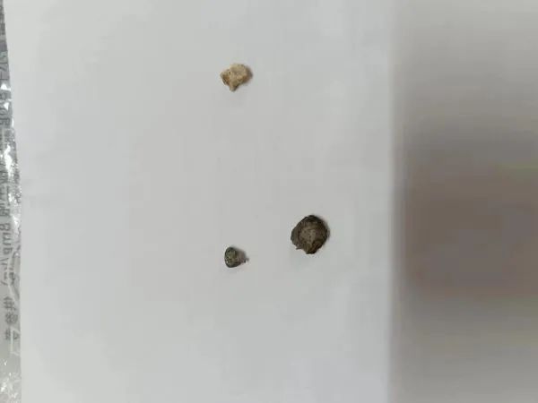 沪上73岁爷叔吃油条磕掉牙？赔偿1万元后反转了，网友：有素养！