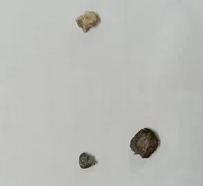 沪上73岁爷叔吃油条磕掉牙？赔偿1万元后反转了，网友：有素养！