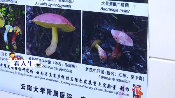 危险!怀孕四个月,孕妇食用野生菌中毒,医生紧急救治 危险!怀孕四个月,孕妇食用野生菌中毒,医生紧急救治