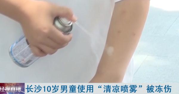 清凉喷雾对脸喷了3圈，女子脸部被冻伤