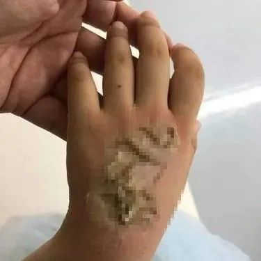 家长们，这个东西，你可能也给你家孩子买过……