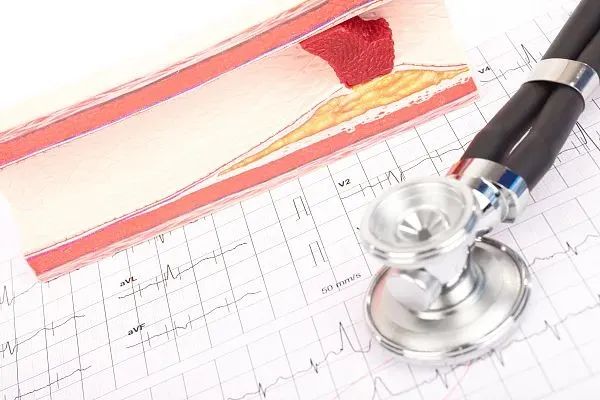 高血脂一直降不下来怎么办？这三类食物尽量少吃！