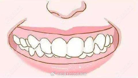 儿童牙齿出现什么问题需要矫正？