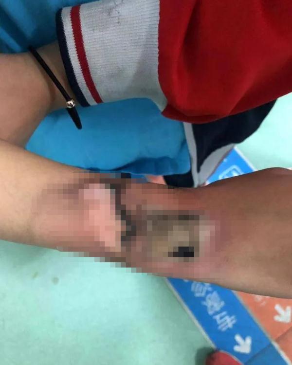 家长们，这个东西，你可能也给你家孩子买过……