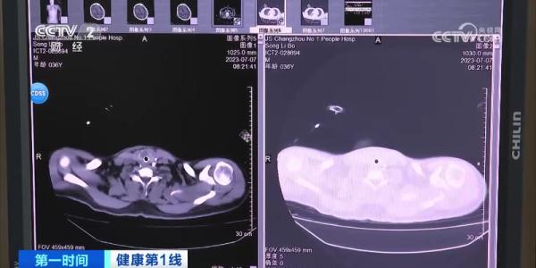 上海这几天有明显降水！大暑究竟有多难熬？有人吹空调，住进ICU？医生紧急提醒→