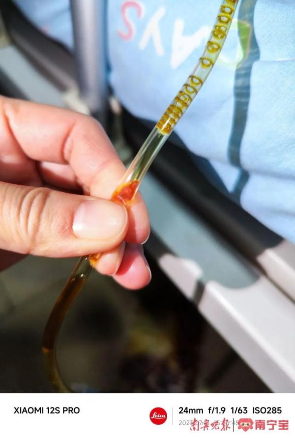 头皮发麻！一女子体内惊现大量“瓜子”活虫，只因家人爱吃鱼生