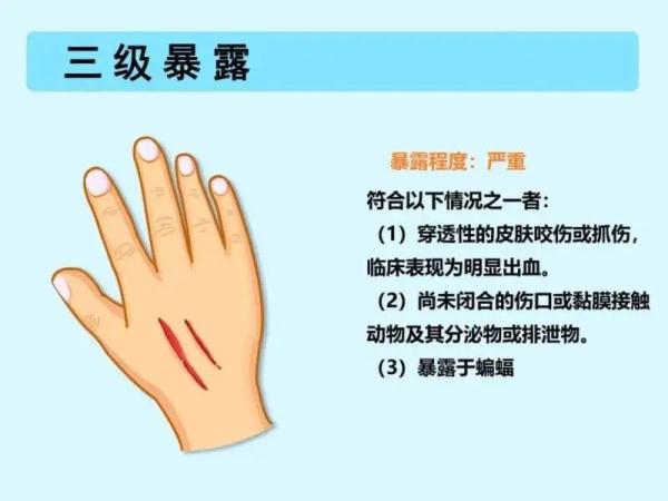 警惕!近期高发!一医院20天接诊4000多人次 警惕!近期高发!一医院20天接诊4000多人次