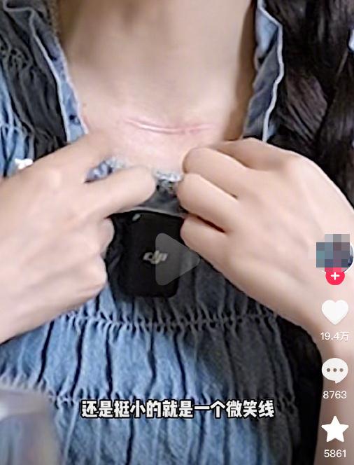 她突然宣布罹患癌症，术后多次想轻生……