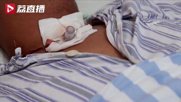 男子狂吃小龙虾，半夜无法呼吸险丧命！