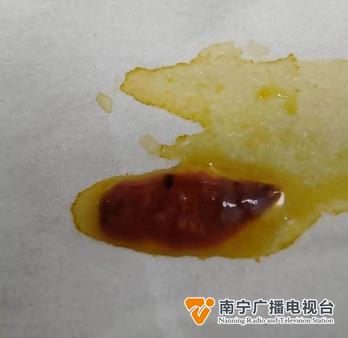 不吃鱼生却长出肝吸虫？原来是因为家里……