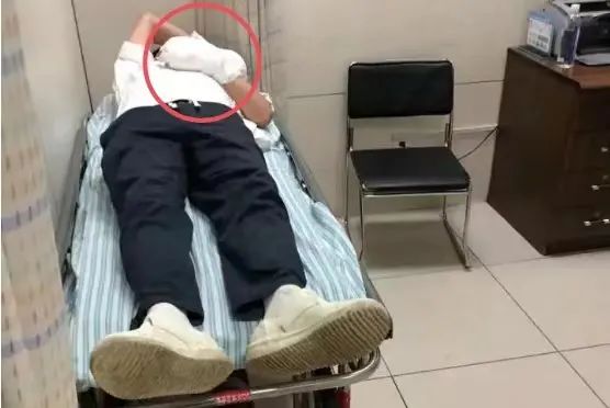 闪爆致8人受伤！警惕这个隐形“炸弹”，很常见