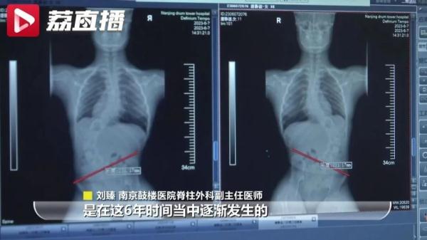 3周接诊5例！教育部、中消协发布提醒！