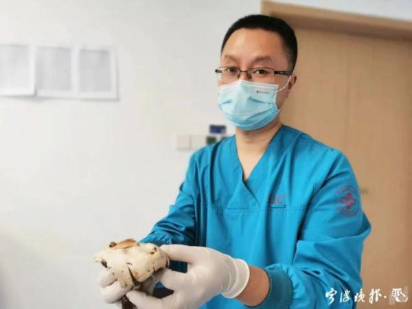 又是因为毒蘑菇!浙江女子命悬一线!当时发现不对,但她还是吃了... 又是因为毒蘑菇!浙江女子命悬一线!当时发现不对,但她还是吃了...