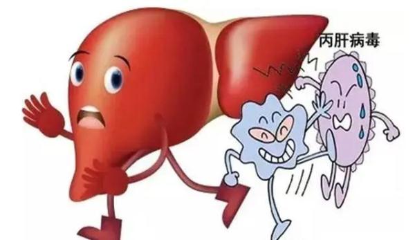 关于丙型病毒性肝炎,这些知识你要了解 关于丙型病毒性肝炎,这些知识你要了解