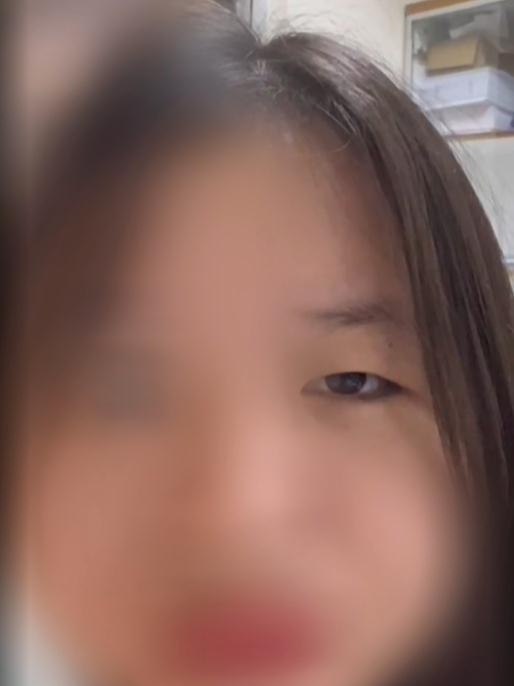 女孩眼皮跳了大半年，一查发现这里出了问题